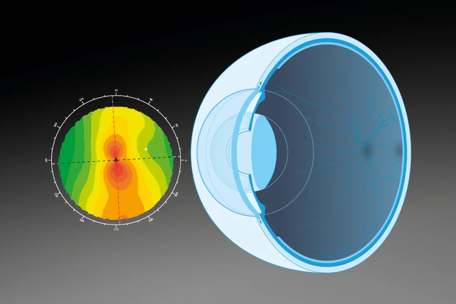 Haag-Streit cornea and anterior-segment analysis