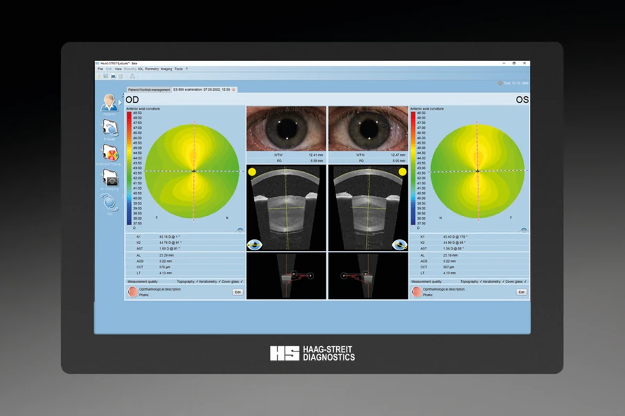 Official Haag-Streit OCT and topography review screen