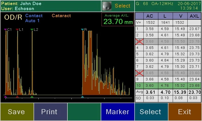 Écran officiel de biométrie A-Scan PIROP