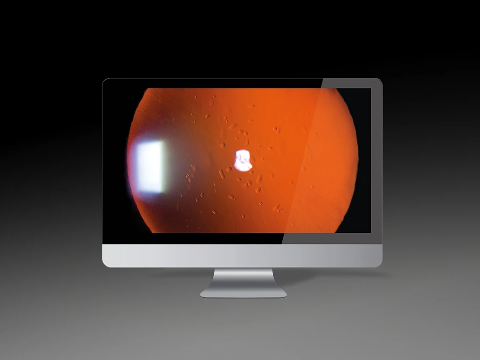 Qualité d’image officielle Imaging Module 910