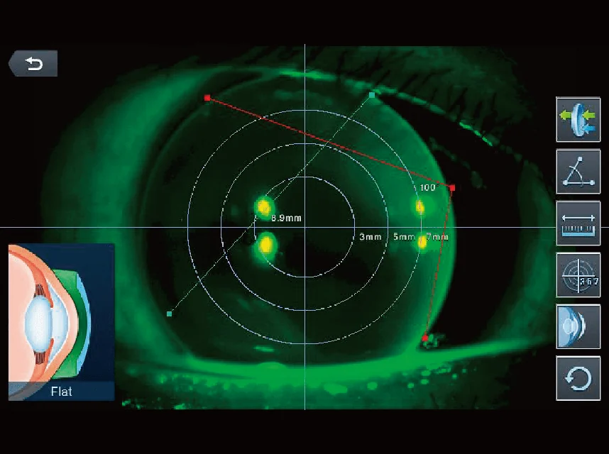 Analyse officielle pour adaptation de lentilles HRK-9000A