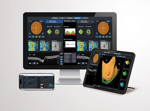 Workflow multi-appareils HIIS de Huvitz