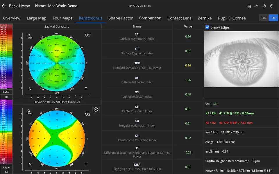 Official AL550 corneal analysis