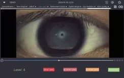 Analyse lacrymale officielle DEA520