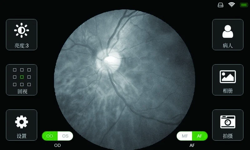 Official FC161 portable workflow