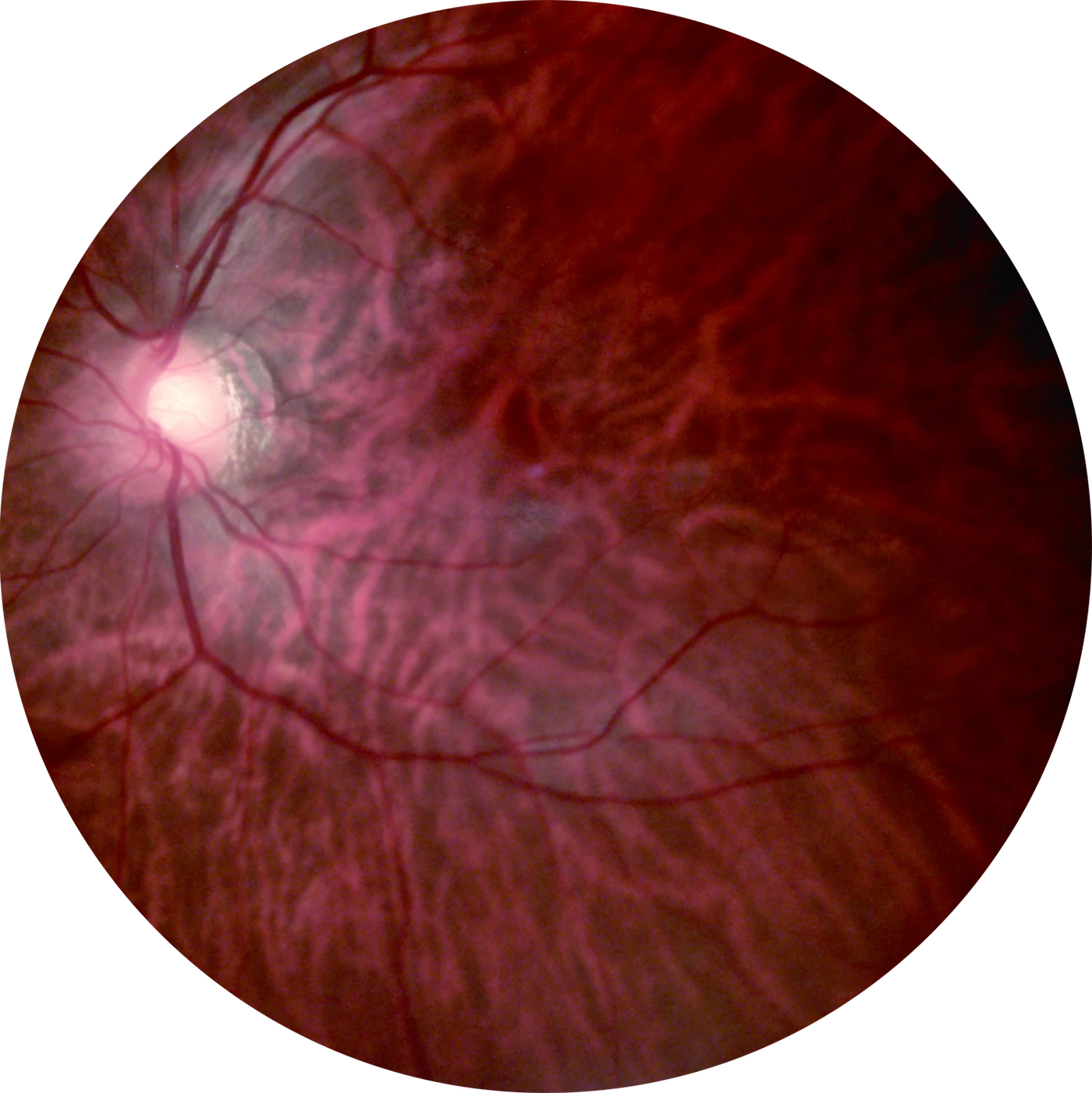 Official FC161 retinal image