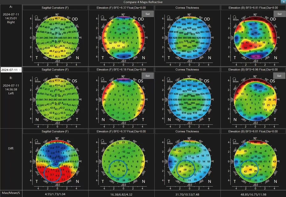 Comparaison officielle de quatre cartes Scansys TA517