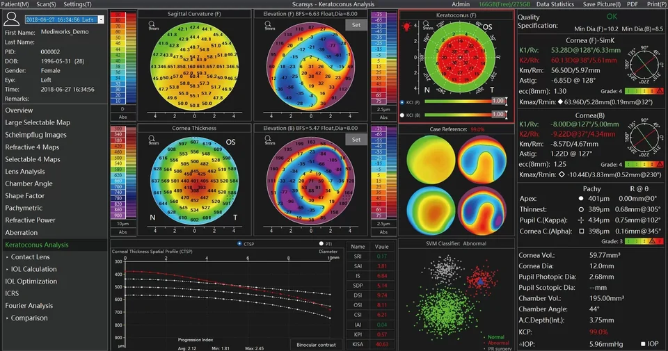 Analyse de kératocône officielle Scansys TA517