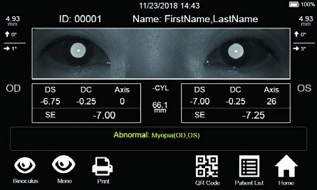 Official V100 binocular screening